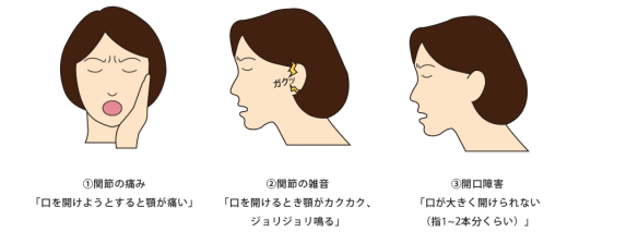 顎関節症の説明画像