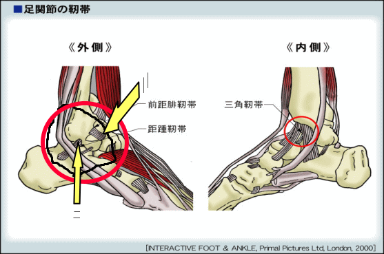 捻挫 じん帯損傷 足関節について